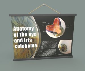 A poster showing the anatomy of a human eye