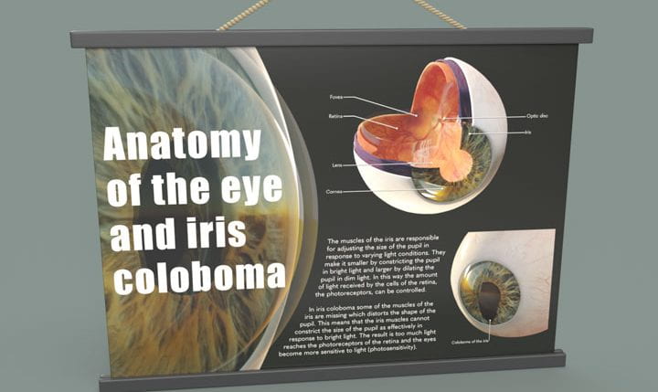 Anatomy of the eye and iris coloboma