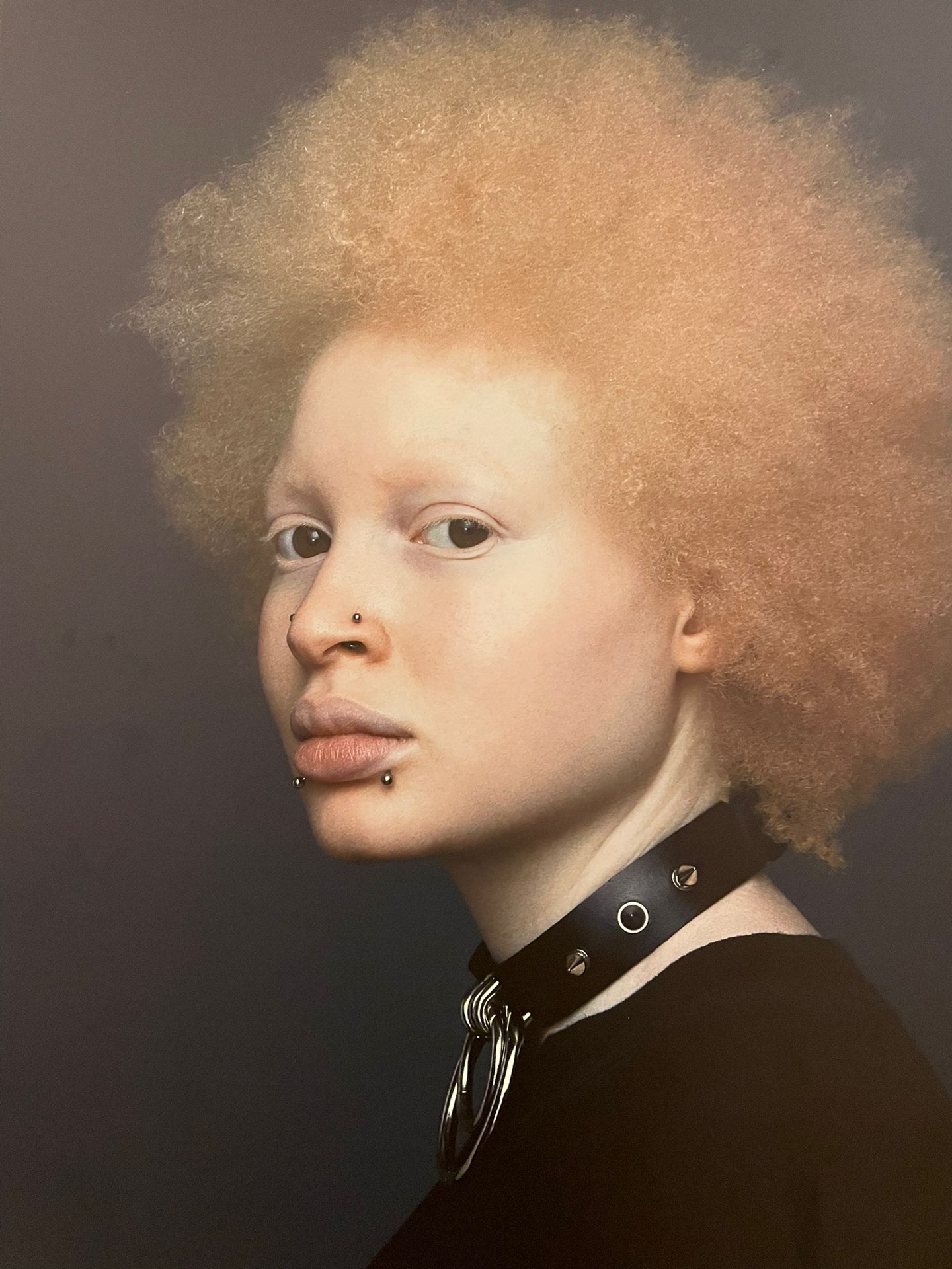 A black women with albinism looks sideways at the camera
