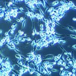 Microscopic image of acute myeloid leukaemia cells attached on optimised bone marrow niche