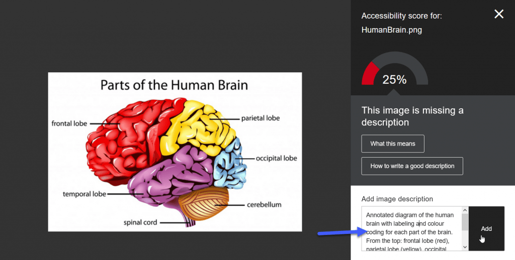 Screenshot showing the Instructor Feedback panel in Ally, a diagram of a brain is shown, the accessibility rating is on the right and a text entry field for a alternative description is provided